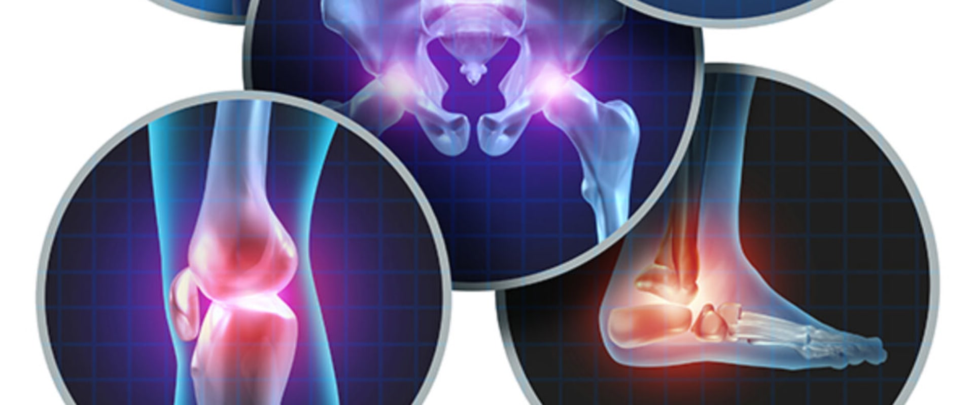 Exploring Surgical Options for Severe Arthritis: A Comprehensive Look at Arthritis Therapy