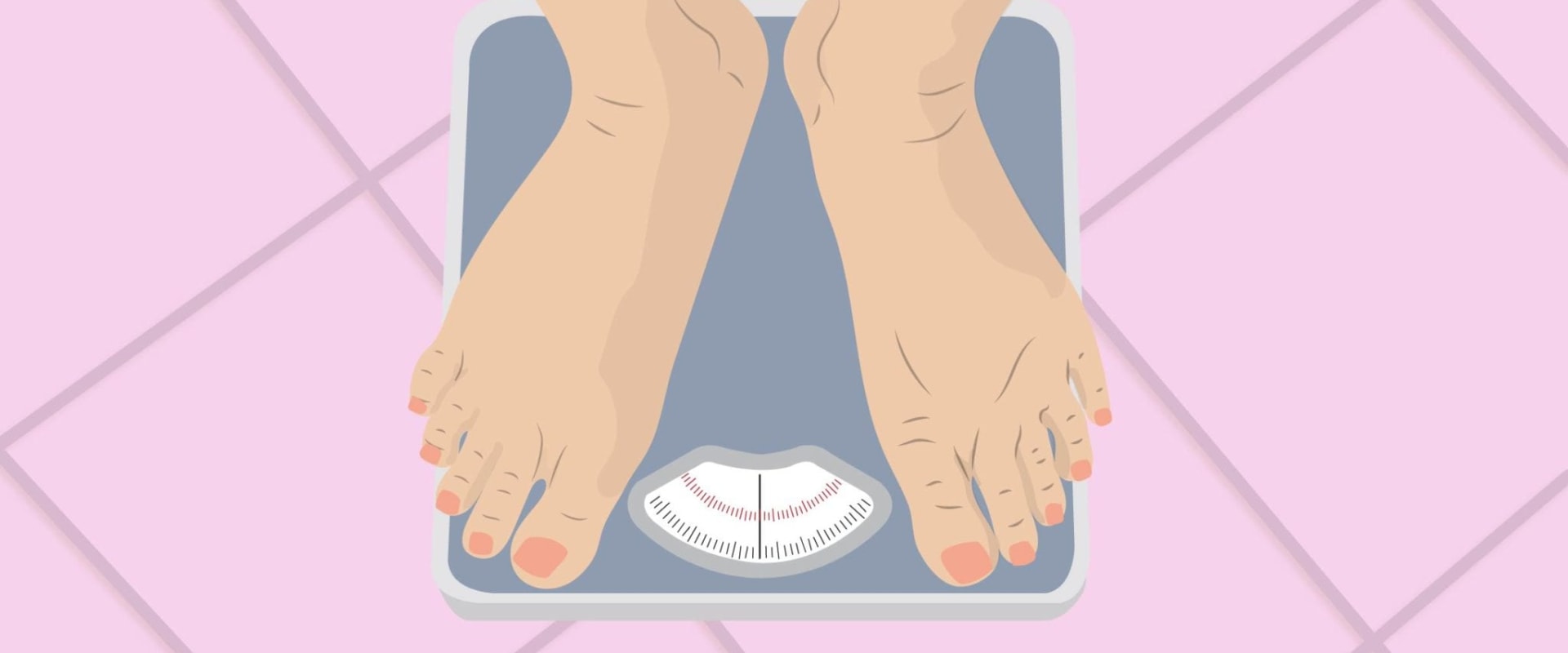 The Impact of Weight Management on Arthritis Symptoms and Therapy