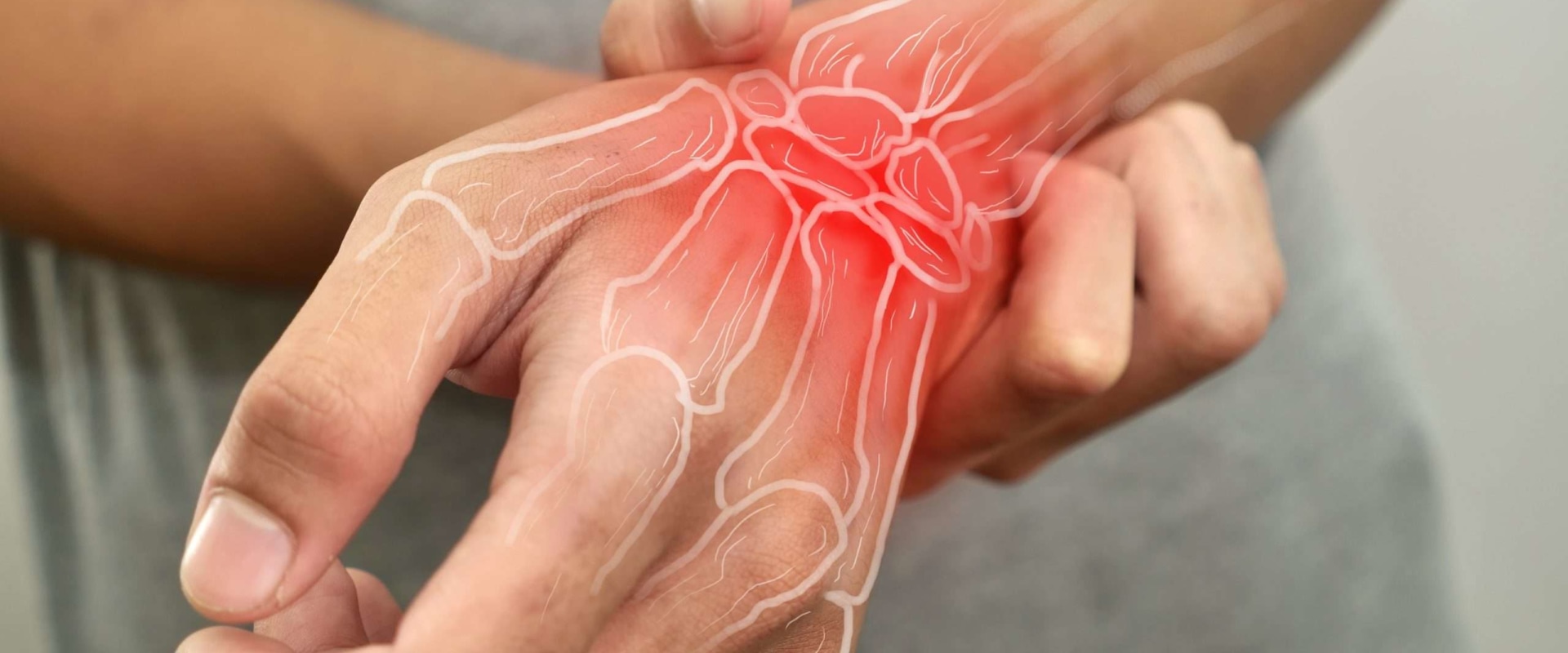 Understanding Arthritis Therapy: Mechanisms, Types, and Benefits