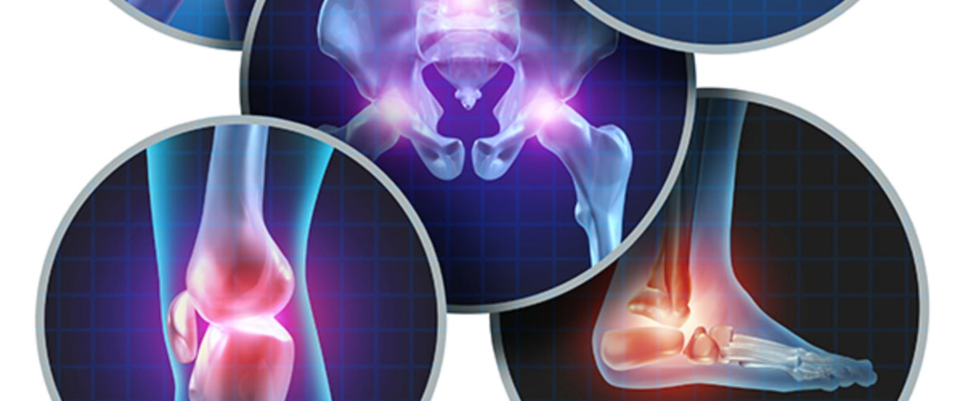 Exploring the Various Types of Arthritis Therapy: A Comprehensive Overview