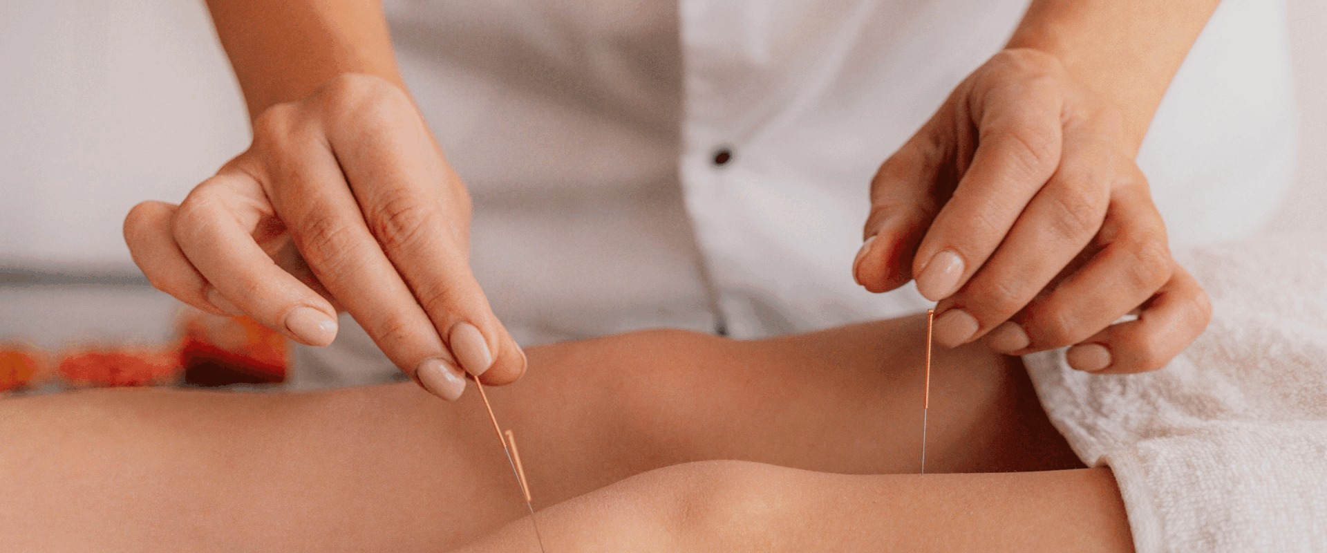 Exploring Acupuncture as an Effective Therapy for Arthritis