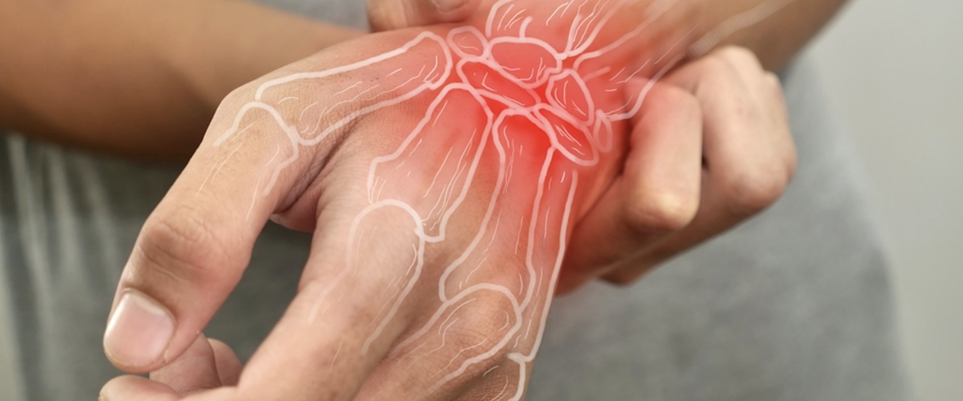 Understanding Who Can Benefit from Arthritis Therapy