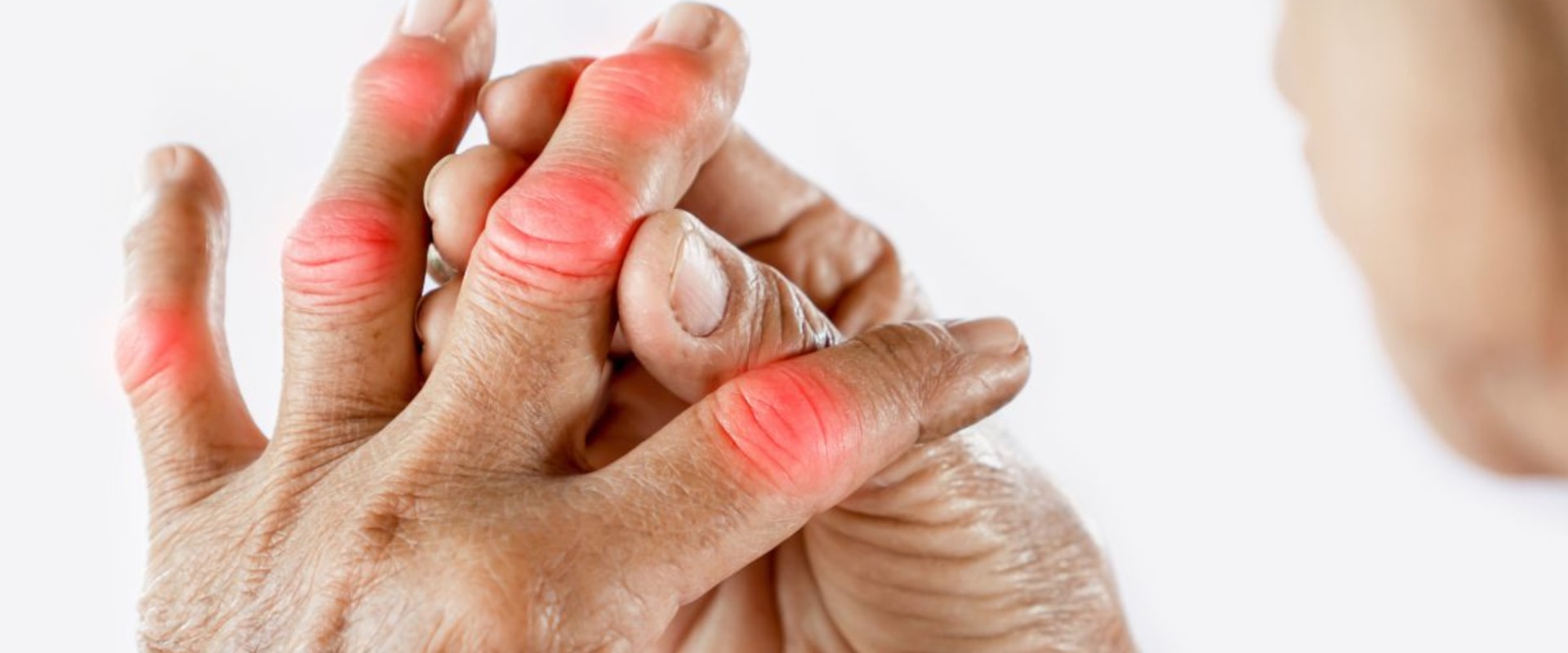 Understanding the Side Effects of Arthritis Therapy