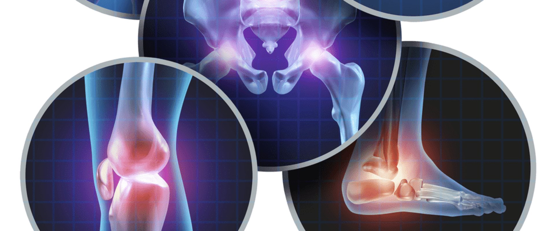 Effective Lifestyle Changes for Managing Arthritis Symptoms