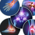 Exploring Surgical Options for Severe Arthritis: A Comprehensive Look at Arthritis Therapy