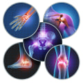 Exploring the Various Types of Arthritis Therapy: A Comprehensive Overview