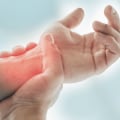 The Critical Role of Early Detection and Treatment in Managing Arthritis Symptoms