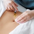 Arthritis Therapy and Expert Lipo Surgeons in Danville