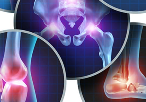 Exploring the Various Types of Arthritis Therapy: A Comprehensive Overview