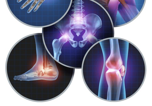 Effective Lifestyle Changes for Managing Arthritis Symptoms