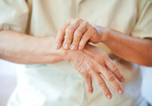 Understanding Insurance Coverage for Arthritis Therapy