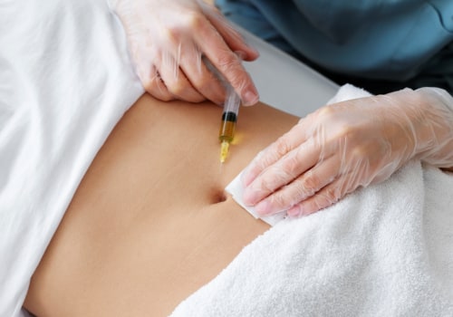 Arthritis Therapy and Expert Lipo Surgeons in Danville