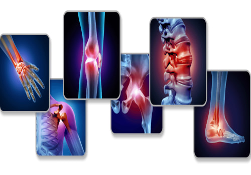 Understanding the Role of Medication in Arthritis Therapy